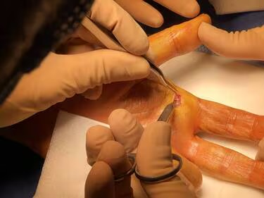 Les blessures dues aux couteaux à huîtres nécessitent quelque fois des interventions chirurgicales