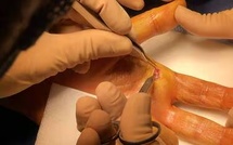 Les blessures au couteau à huîtres explosent à Noël (2000 graves)